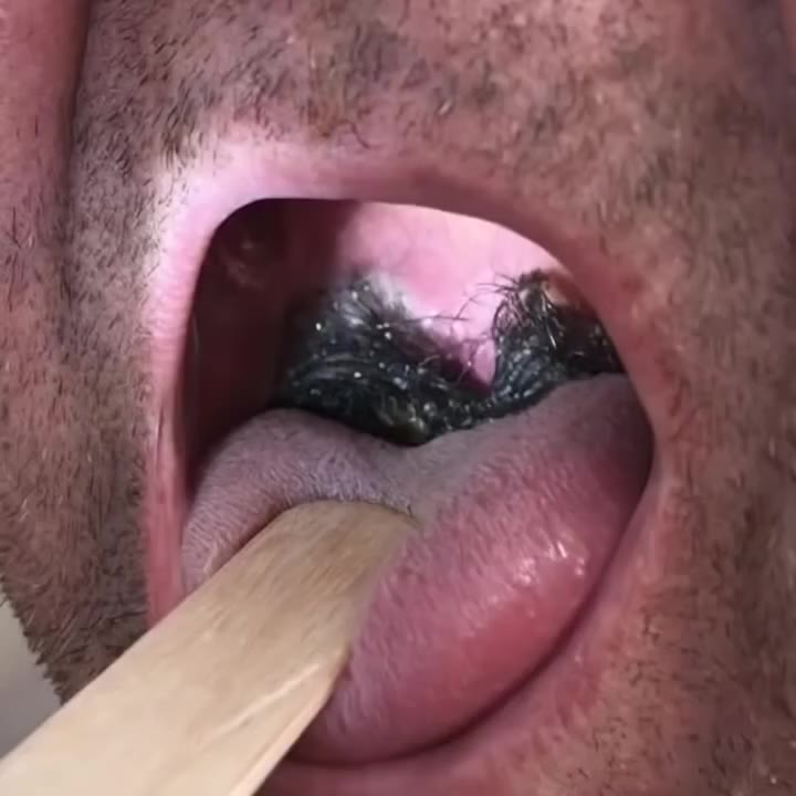 The Cost of Compromised Connection