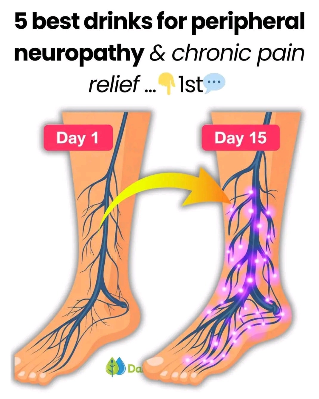 5 best drinks for peripheral neuropathy & chronic pain relief