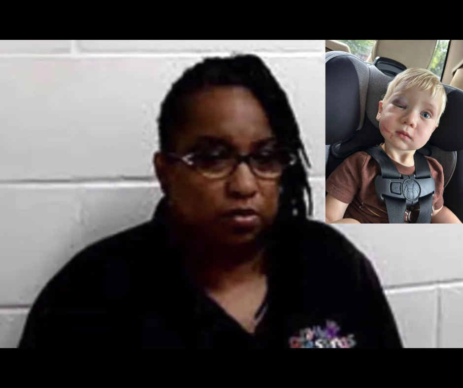 Daycare worker arrested after toddler arrives with black eye and swollen face on first day
