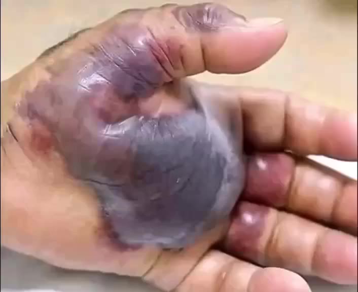 Don’t Wait for Warning Signs: Recognize the Red Flags of Untreated Infections!