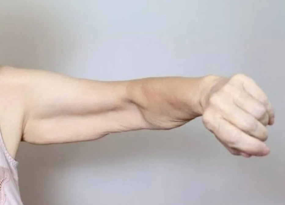 Sarcopenia: Causes of Muscle Loss and Solutions