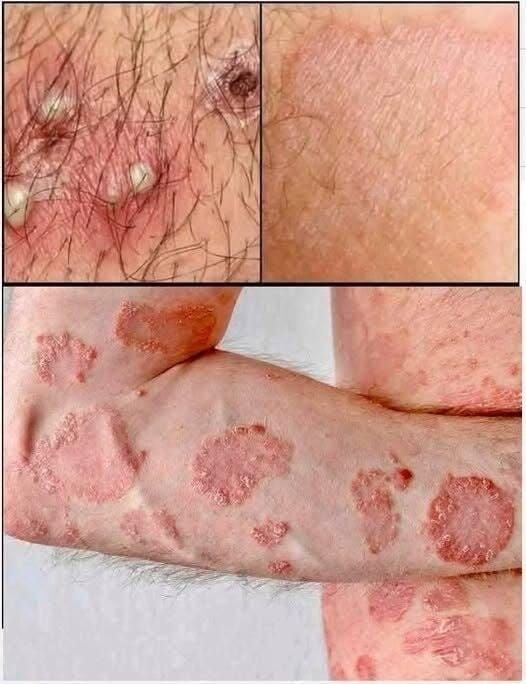 These are the consequences of sleeping with the.