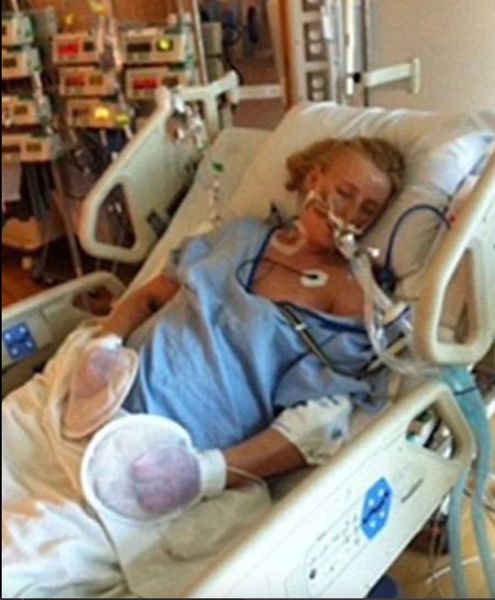 She Lost Both Legs After Using a Common Product – Now She’s Warning Others