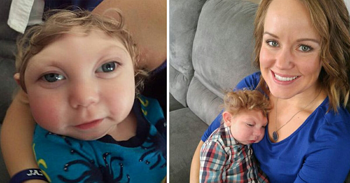 ‘Miracle Baby’ Born Without Most of His Brain Defied All Odds — Heartbreaking Update