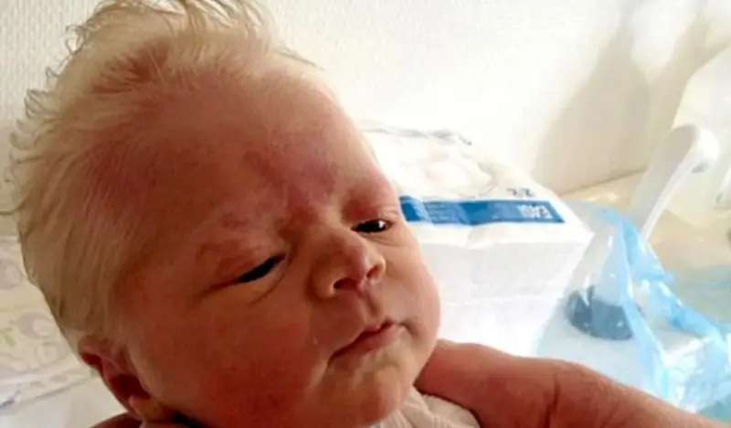 The Baby Born With Snow-White Hair — Doctors Were Stunned