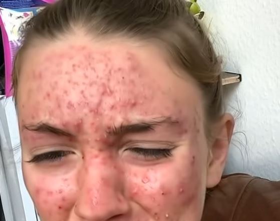 The Unseen Warning: How a Simple Itch Changed Everything