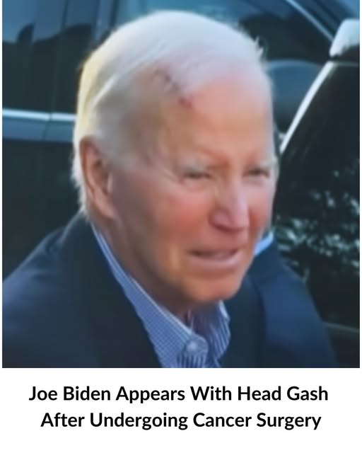 Joe Biden Appears With Head Injury After Undergoing Cancer Surgery