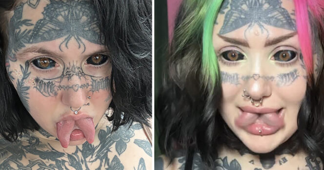 Orylan Spent $70K on Extreme Transformation — Her Before Photos Leave Everyone Stunned